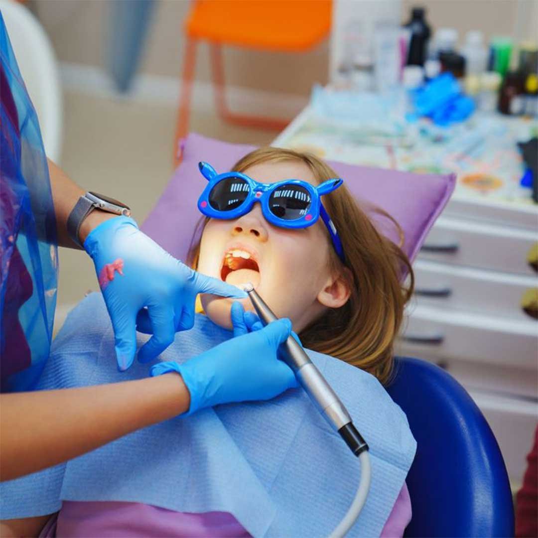 A child receiving mild sedation at a San Diego pediatric dentist's office with a supportive team present.